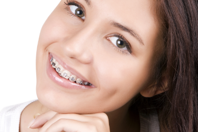 Girl with braces Collegeville Dentistry