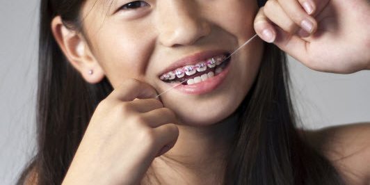 cavities and stress cavities and stress