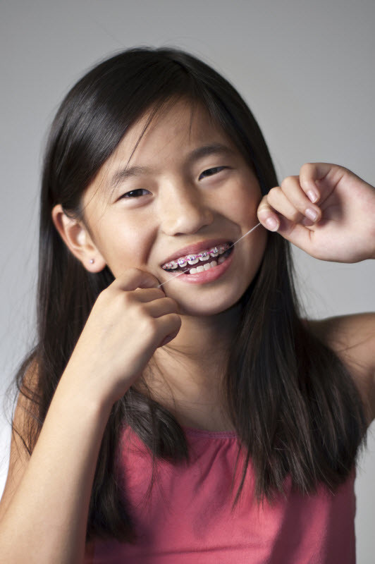 cavities and stress cavities and stress