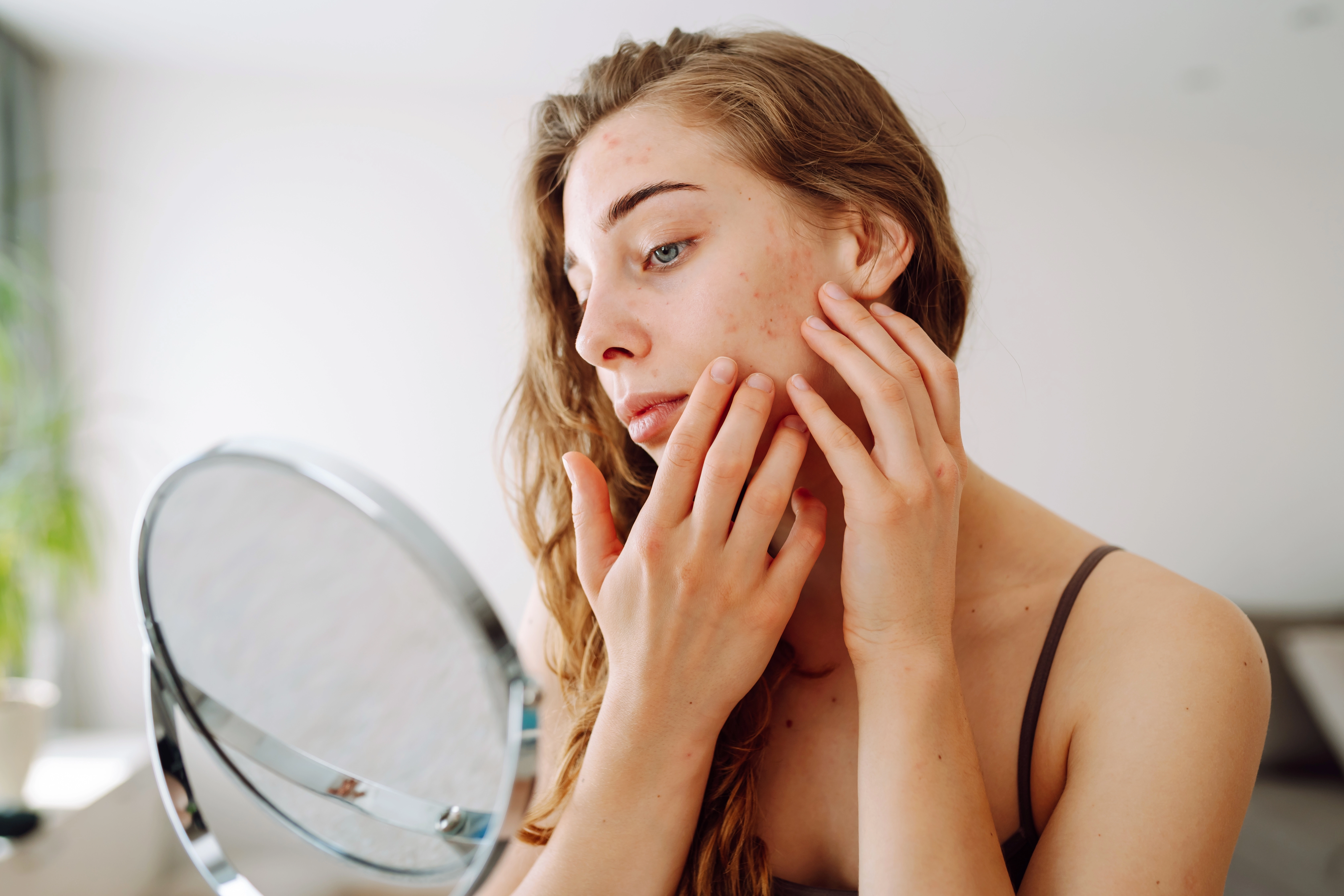 Young woman examining mild acne on her cheek in soft light