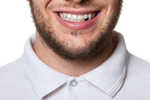 Missing teeth | collegeville advanced dentistry Missing teeth | collegeville advanced dentistry