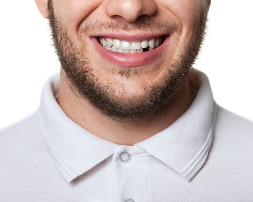 Missing teeth | collegeville advanced dentistry Missing teeth | collegeville advanced dentistry